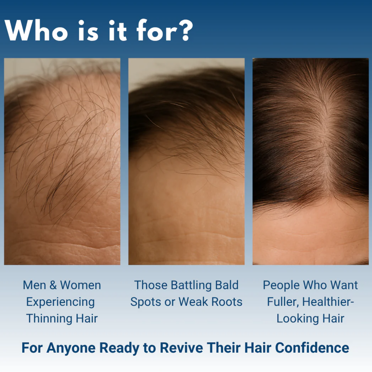 Advanced Hair Growth Roll-On Serum