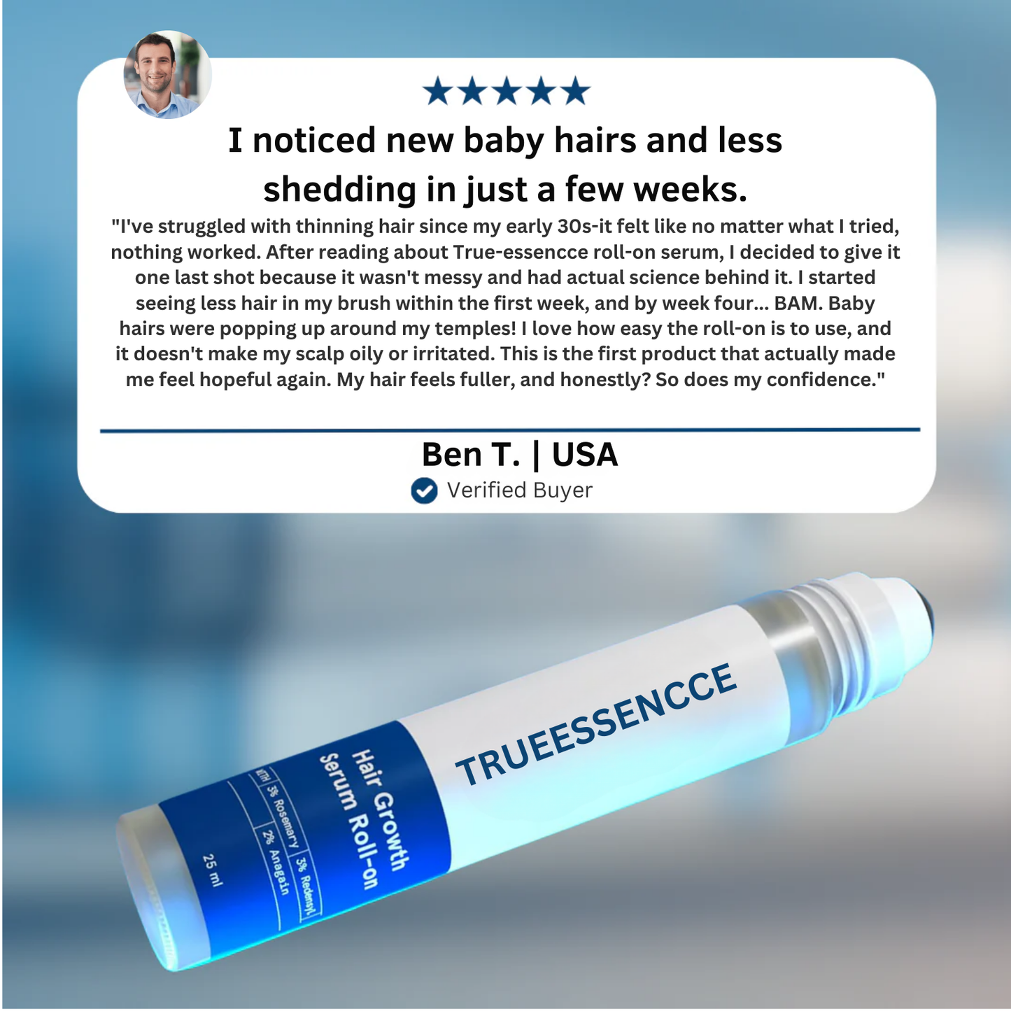 Advanced Hair Growth Roll-On Serum