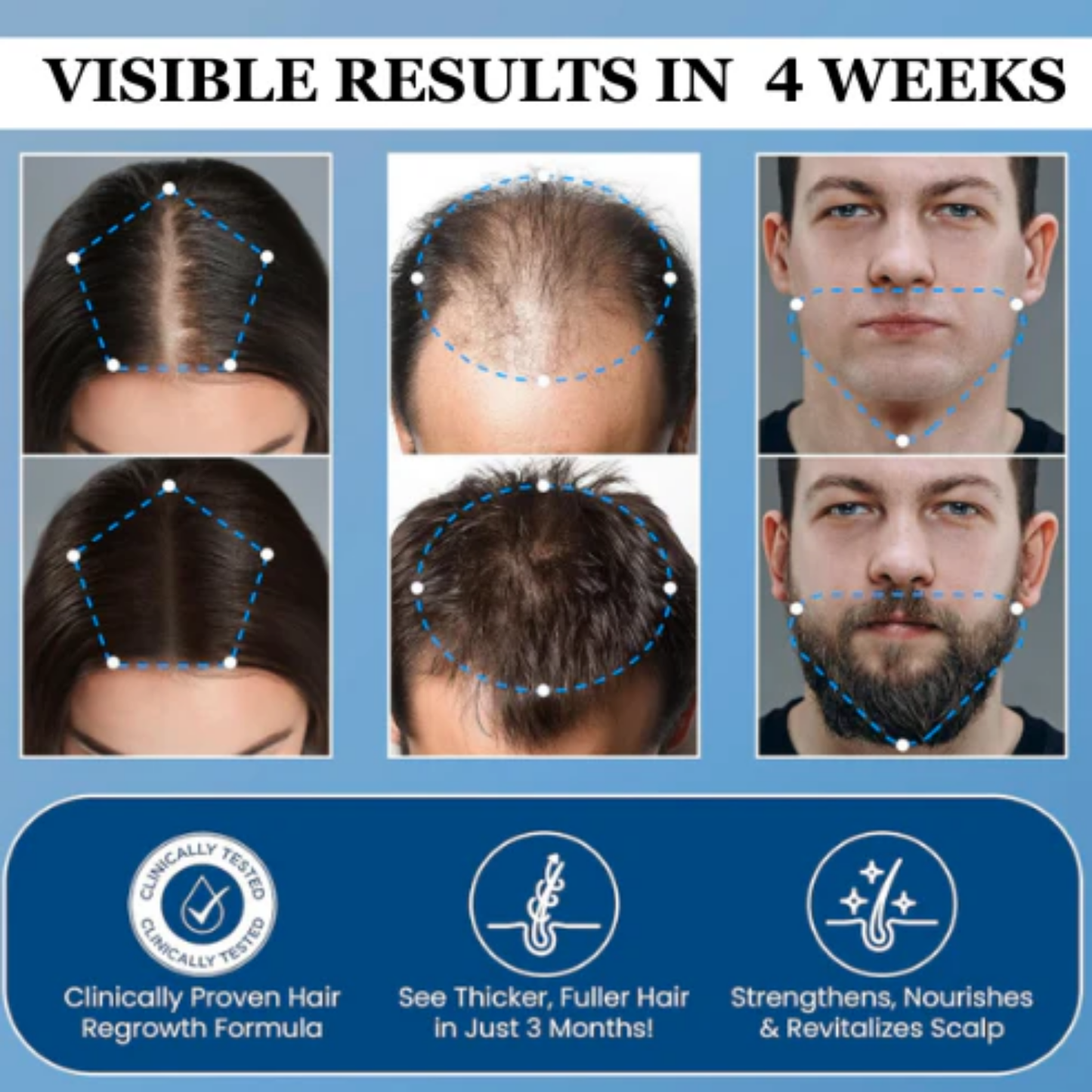 Advanced Hair Growth Roll-On Serum