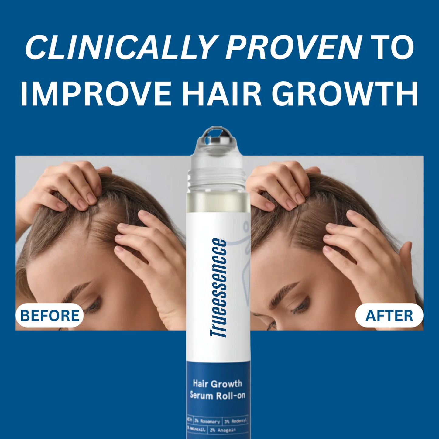 Advanced Hair Growth Roll-On Serum