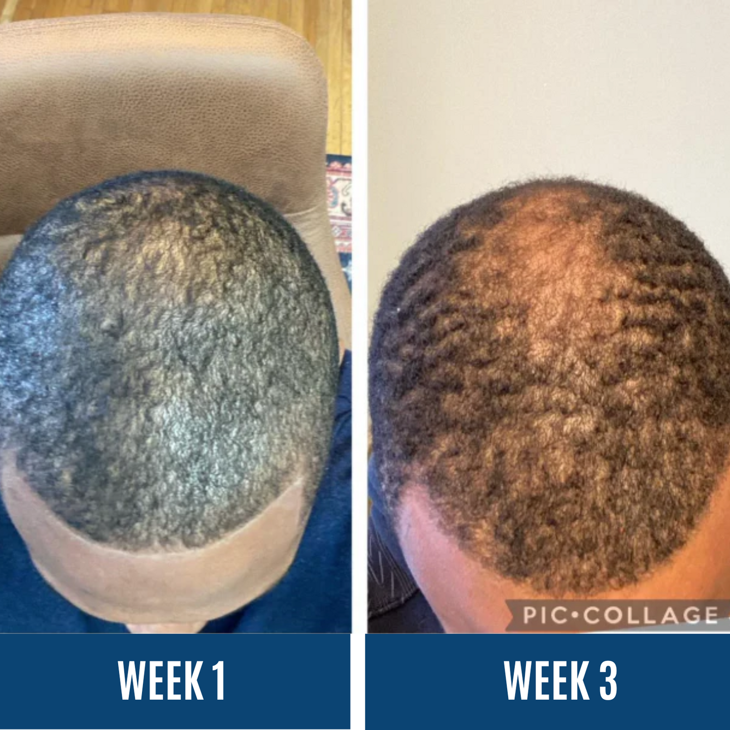 Advanced Hair Growth Roll-On Serum