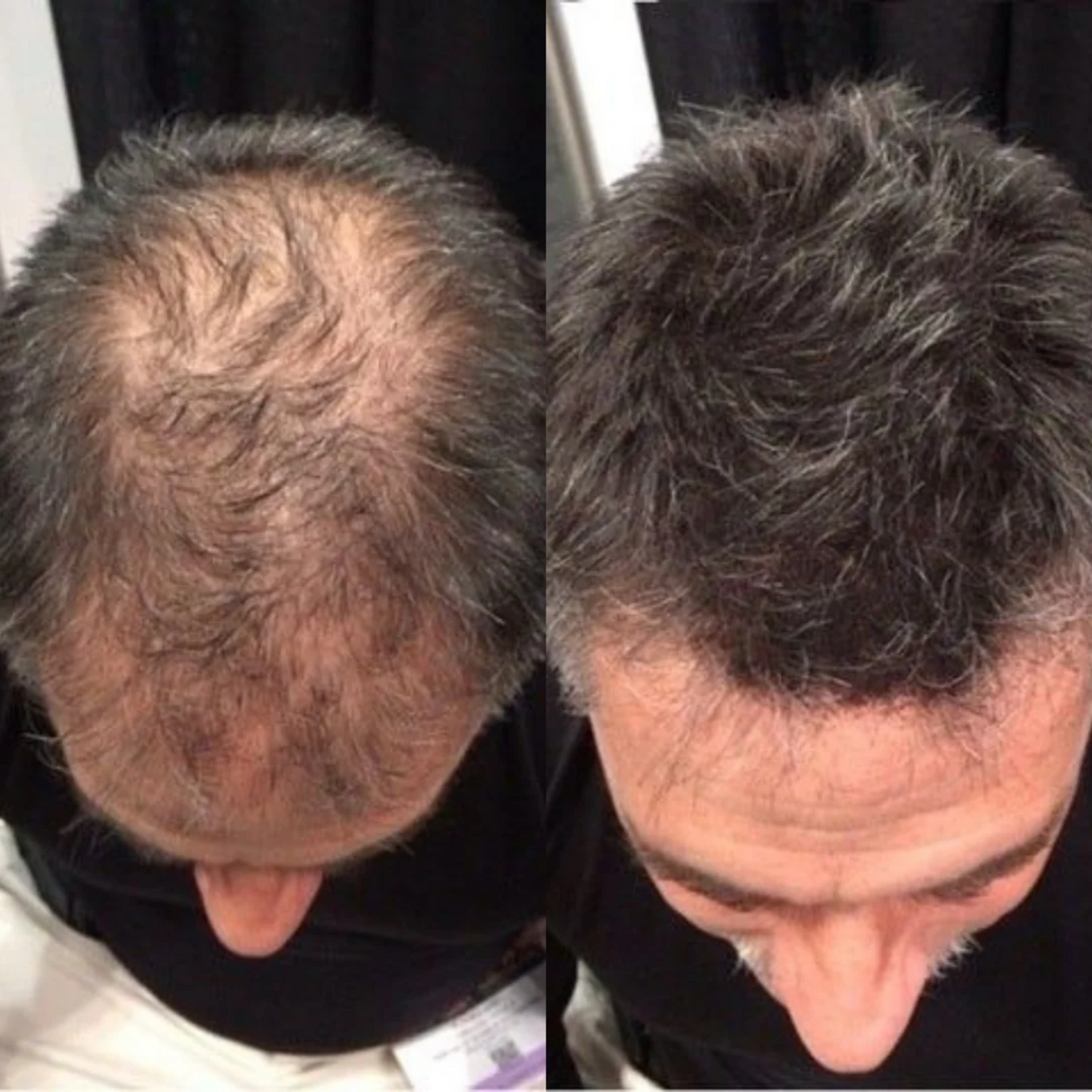 Advanced Hair Growth Roll-On Serum