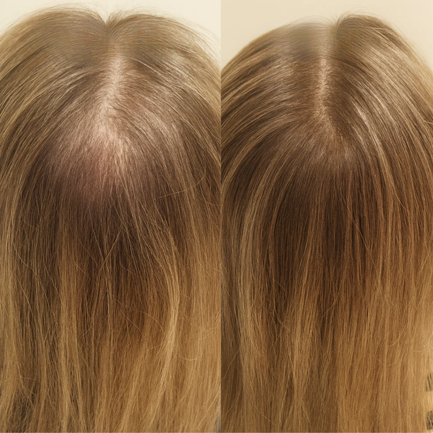 Advanced Hair Growth Roll-On Serum