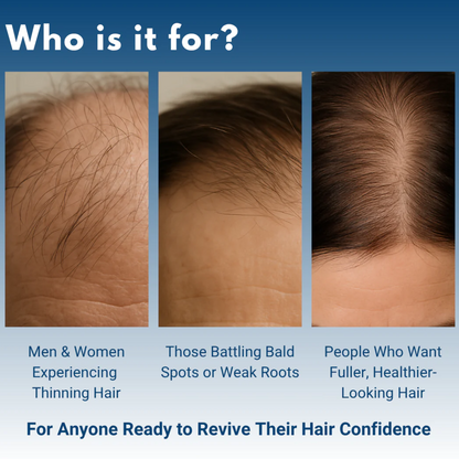 Advanced Hair Growth Roll-On Serum