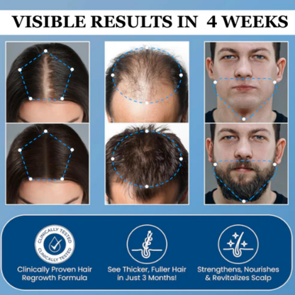 Advanced Hair Growth Roll-On Serum