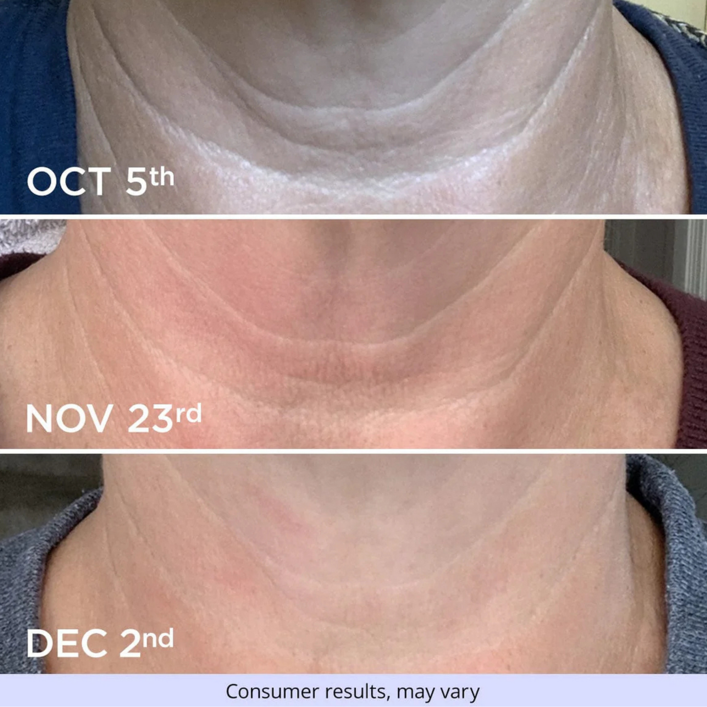 Neck-Lift Pro