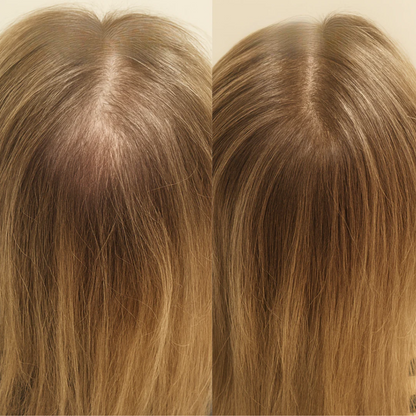 Advanced Hair Growth Roll-On Serum